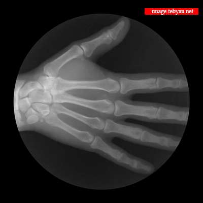 تصویر متحرک، استخوان، اشعه ایکس