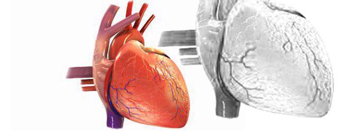 پزشک چطور متوجه نارسایی قلبی می شود؟