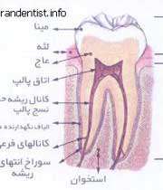 علت دندان درد 1