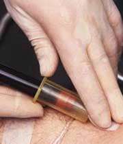 خون گیری از بیمار