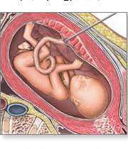 جنین در بارداری