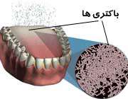 تجمع باکتری ها روی زبان