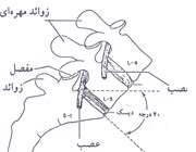 کمر درد و ورزشهای درمانی آن