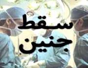احکام شرعی سقط جنین