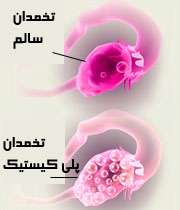تخمدان