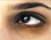 حلقه سیاه اطراف چشم
