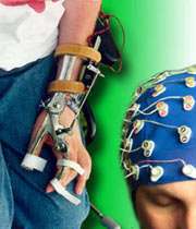 فالج زدہ شخص