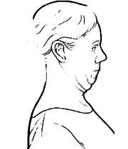 ورزش برای آرتریت