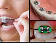 روش های زیبا کردن دندان