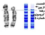 سندرم صدای گربه