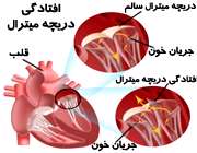 پرولاپس دریچه میترال, بیماریهای قلب و عروق