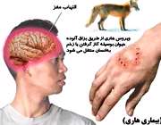 بیماری هاری