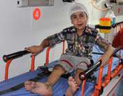 اسکانیا ، تصادف