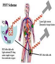 درمان فتودینامیک چیست؟