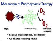 درمان فتودینامیک چیست؟