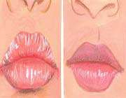 cracked, chapped and dry lip