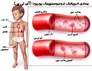 وقتی بدن خودبخود کبود می شود 1