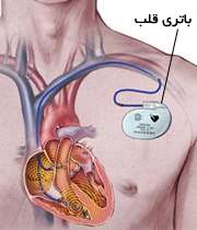 مراقب باتری قلب‌تان باشید 1