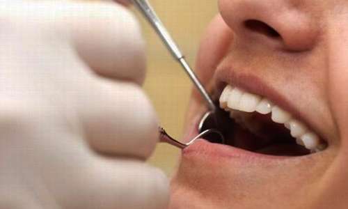 معاینه دندان ها