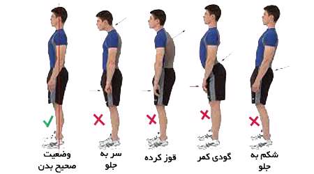 حالت ایستادن صحیح و غلط